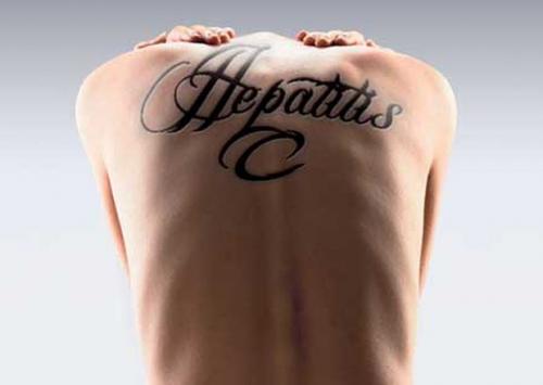 Contagio de hepatitis por tatuajes y piercings